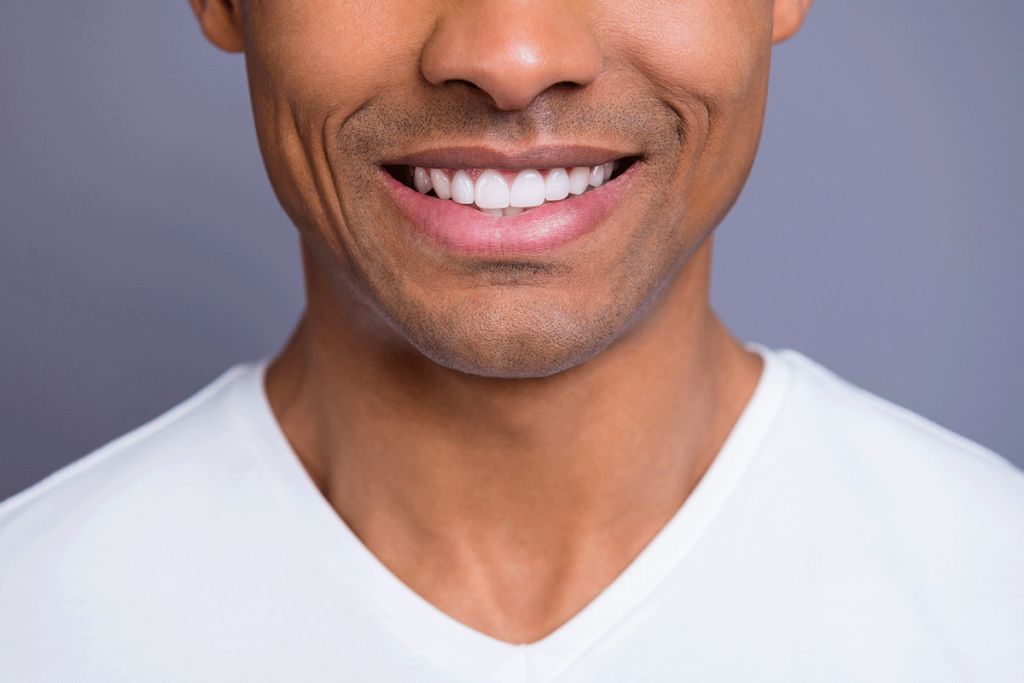 Teeth Whitening Options For You
